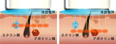 痛み・身体への負担軽減