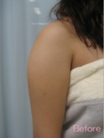 Before